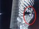 19岁女生腹痛就诊否认怀孕 2小时后分娩